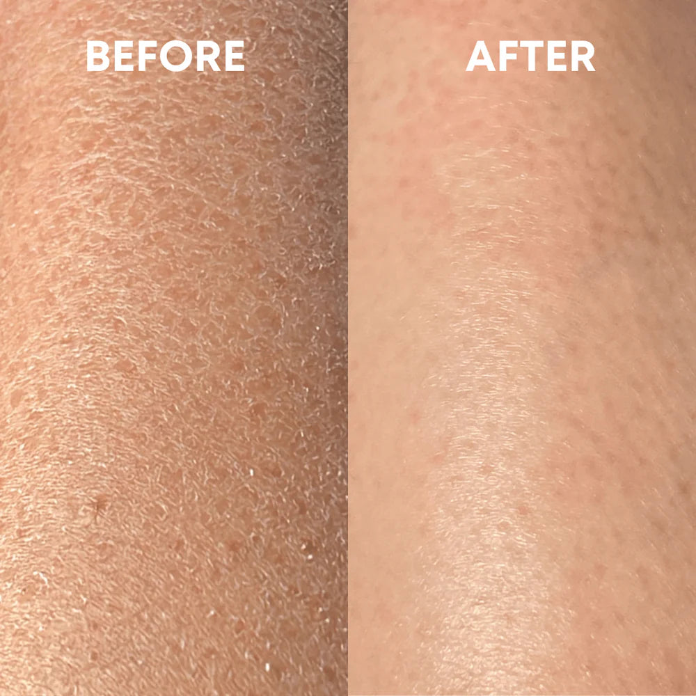 Smooth Skin Magic Mitt